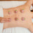 Cupping therapy kit with six suction cups for muscle relief and relaxation.