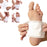 Kinoki Cleansing Detox Foot Pads, Ginger & salt Foot Patch - 30pcs (Set of 3)