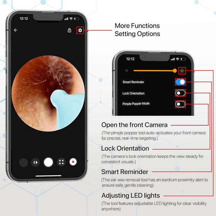 Smart Ear Cleaner Kit with HD Camera & WiFi – 6 LED Endoscope Tool for Android/iOS + 11 Free Silicone Tips (White)