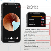 Smart Ear Cleaner Kit with HD Camera & WiFi – 6 LED Endoscope Tool for Android/iOS + 11 Free Silicone Tips (White)